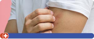 Insect and Animal Bites Treatment Near Me in Cincinnati, OH Insect and Animal Bites Treatment Near Me in Cincinnati, OH