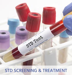 STD Screening and Treatment Near Me in Cincinnati OH - Eastside Urgent Care