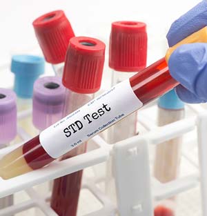 STD Testing Near Me in Cincinnati, OH