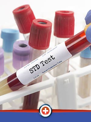 STD Test and Treatment Near Me in Cincinnati, OH