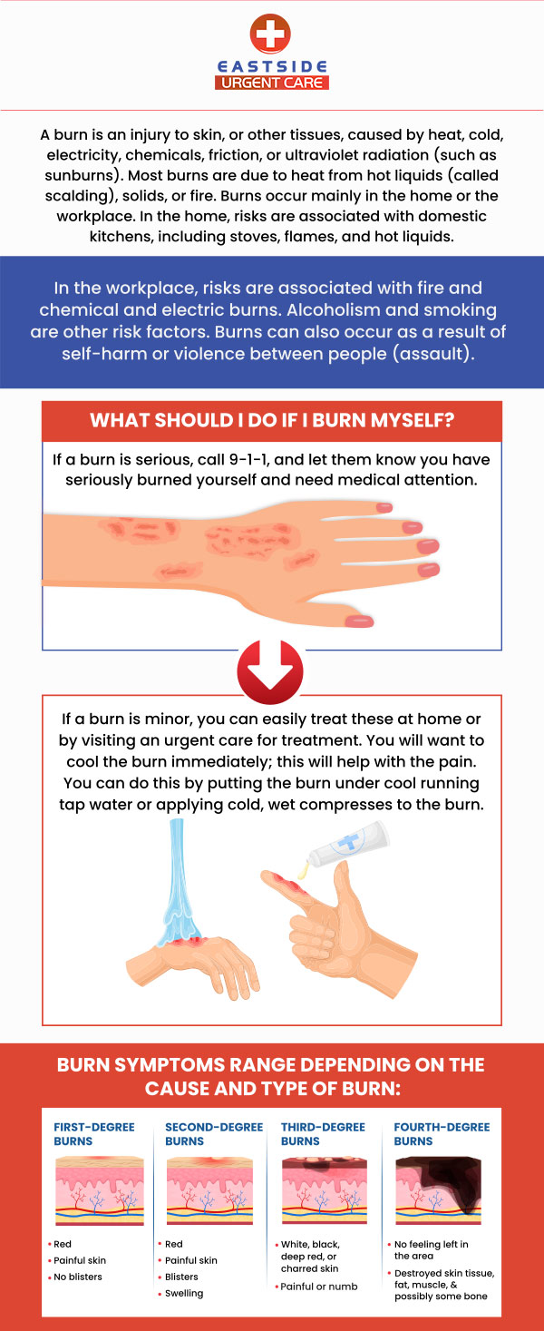 Eastside Urgent Care is well equipped to handle most emergency situations including effectively treating burns from chemical or heat exposure. If you any level of burn from first degree to third degree, please consult a specialist for better care and treatment. Walk-in today or contact us to schedule a same-day appointment to avoid wait time. We are conveniently located at 872 Ohio Pike Cincinnati, OH 45245.