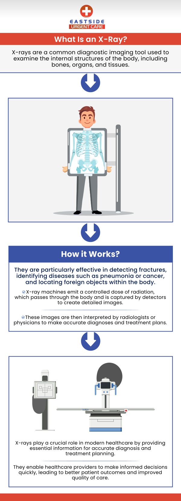 X-rays are a type of diagnostic imaging that uses radiation to create images of bones, organs, and tissues inside the body. The benefits of X-rays include that they are non-invasive, quick, painless, help diagnose a wide range of conditions, and require minimal radiation exposure. At Eastside Urgent Care, Dr. Noor U. Hassan, MD, and Dr. John Pressler, MD provide X-ray services that are intended to aid in accurately diagnosing a range of medical conditions. We offer X-ray services to patients of all ages and are dedicated to giving each patient a comfortable and secure atmosphere. For more information, contact us or book a same-day priority appointment. We are conveniently located at 872 Ohio Pike Cincinnati, OH 45245.